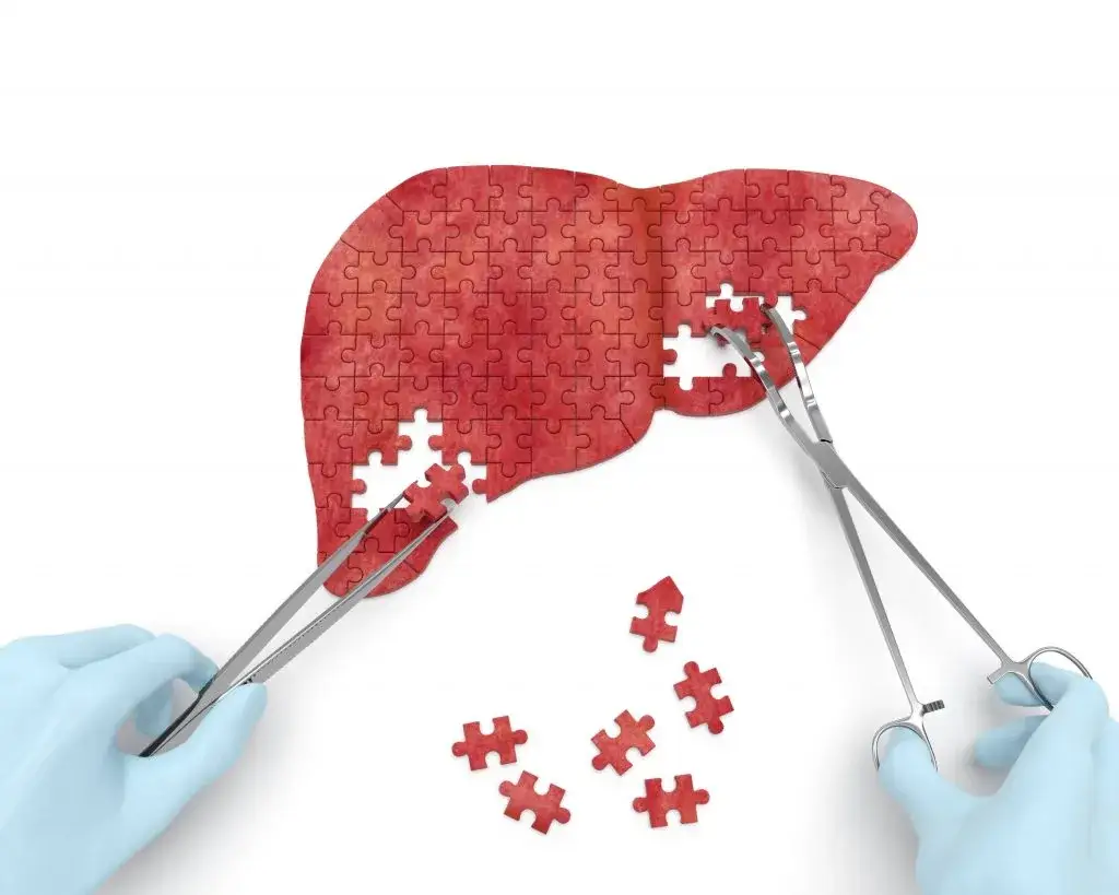 djt cholangiocarcinoma 1 1024x819