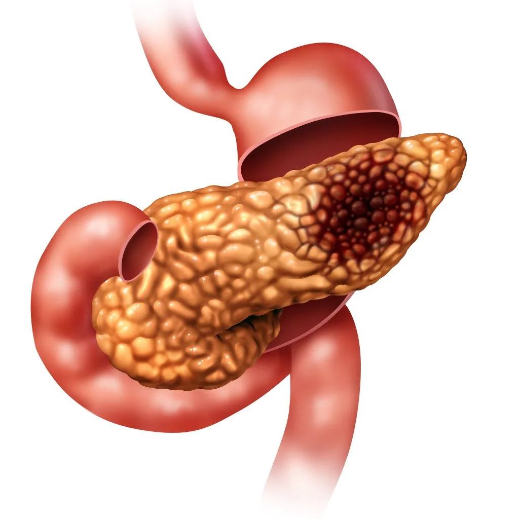 djt pancreas 1 1024x1024